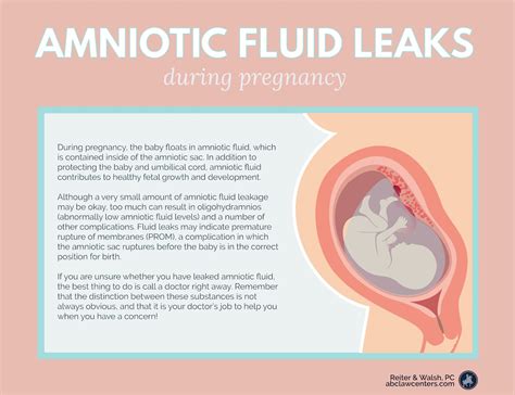 leaking amniotic fluid symptoms|Leaking Amniotic Fluid: How to Tell